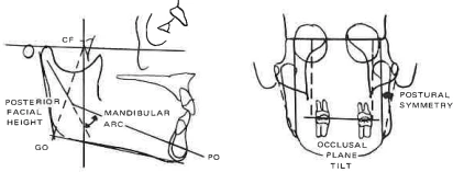 Manual Illustration